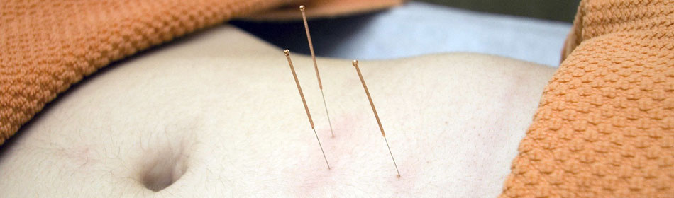 Accupuncture, Eastern Healing Arts in the Easton, Lehigh Valley PA area